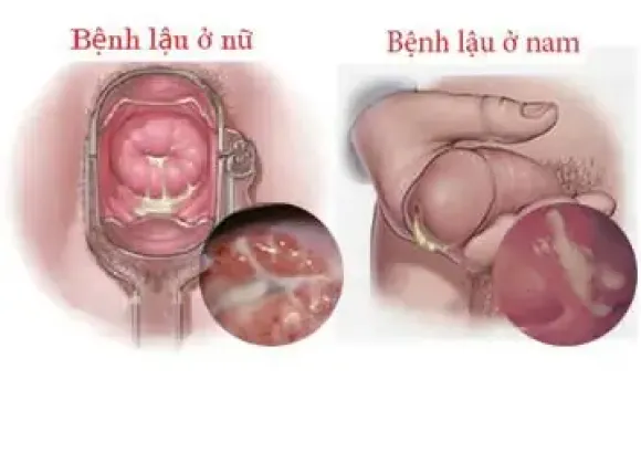Bệnh lý Da - Tóc - Móng.