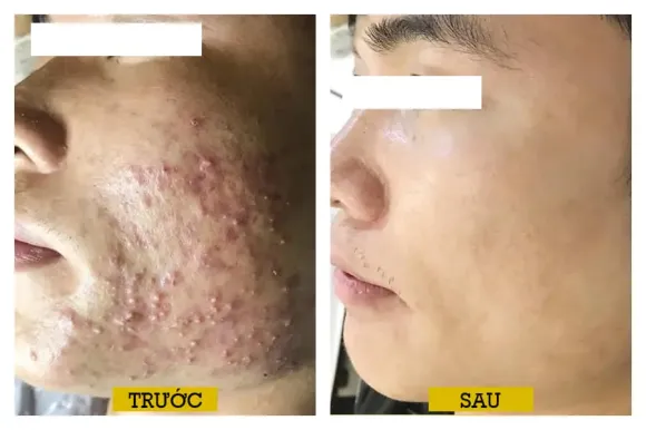 Bệnh lý Da - Tóc - Móng.